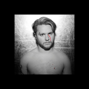 Schenk – Lobotomy