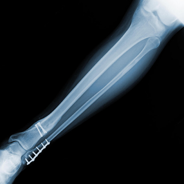 Lake Rana – Bad&nbsp;Year