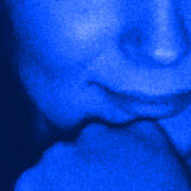 @melissageurts – emotional subtxt